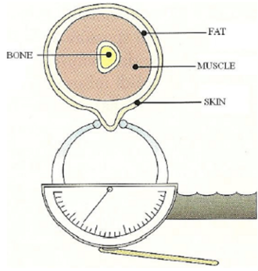 skinfold calipers